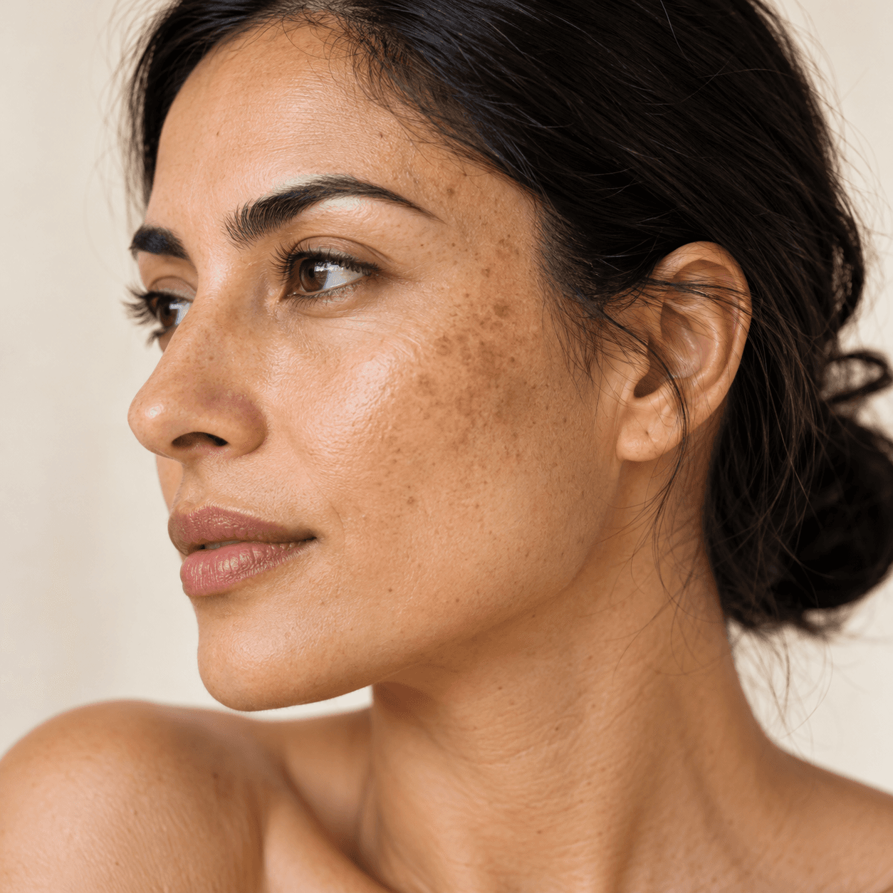 Pigmentation & Sun Damage — skin concern portrait