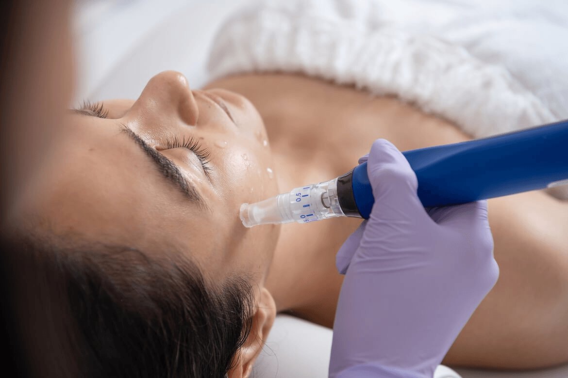Microneedling & Skin Booster